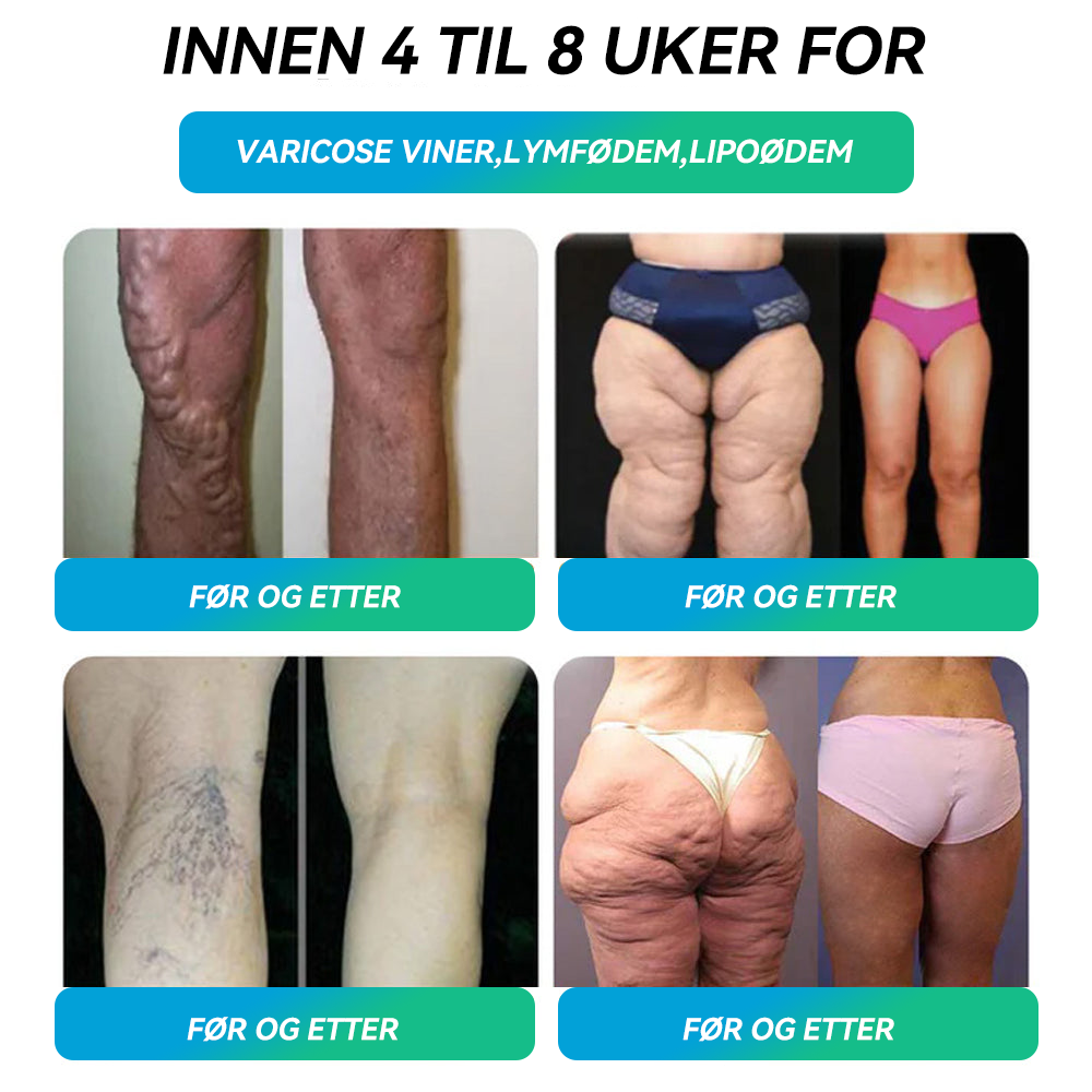 Utholdenhet = Resultater! 🎯 30 % HHVB-rabatt i en begrenset periode. Mange brukere velger å kjøpe 6 esker om gangen (60 DAGERS forbruk), da dette ikke bare stabiliserer resultatene, men også lar dem dra nytte av det fantastiske kombotilbudet! 👍